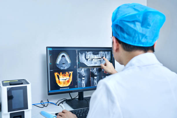 Best Emergency Treatment for Dental Infections or Abscesses in Belmont, CA