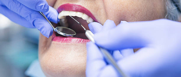 Best Urgent Care for Lost Fillings or Crowns in Belmont, CA